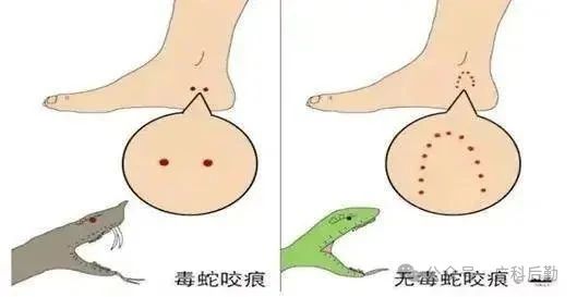 应急小常识 | 进入高发季！如何防蛇自救？